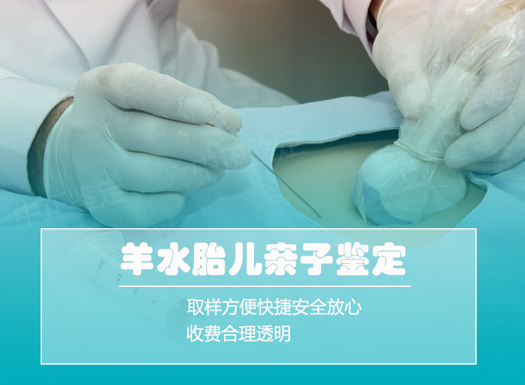 湖州羊水孕期亲子鉴定